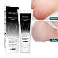 Wholesale OMY LADY Mango Pregnancy Stretch Marks Repair Scar Slack Line Abdomen Stretch Mark Cream