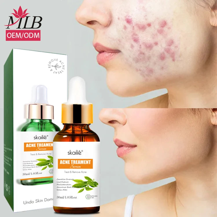 Private Label Natural Tea Tree Extract  Acne Face Serum Repairing Tea Tree Facial Acne Care Men Women Skin Care