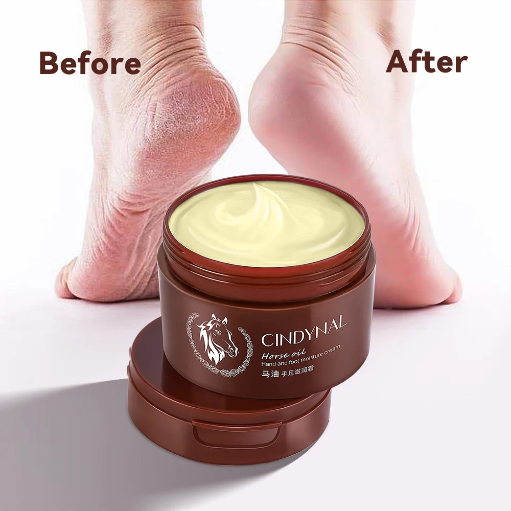 CINDYNAL Wholesale Moisturizing Anti Dry Foot Crack Repair Urea Horse Oil Hands  Feet Foot Care Cream for Cracked Heels