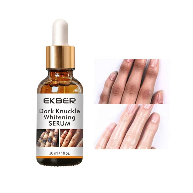 Hot Sale Fast Whitening Dark Knuckle Remover Serum Pigmentation Effective Exfoliating Dark Sports Removal for Hands Knuckle
