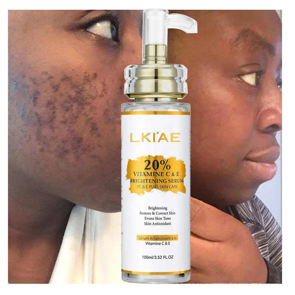 OEM ODM Blemish Dark Spot Correcting Glow Lightening Dark Knuckles Fast Face Vitamin C Whitening Serum for Black Skin