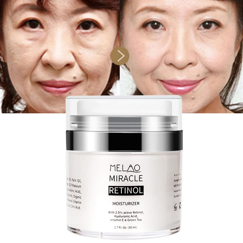 Private Label Facial Cream Anti Aging Anti Wrinkle Deep Moisturizing Hyaluronic Acid Retinol Face Cream
