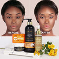 Private Label Bleach Layers to Brighten Collagen Carrot 4in1 Skin Care Set Brilliant Skin Rejuvenati for Caramel Skin