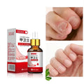 Anti Fungal Treatment Nail Onychomycosis Paronychia Infection Toe Finger Repair Nails