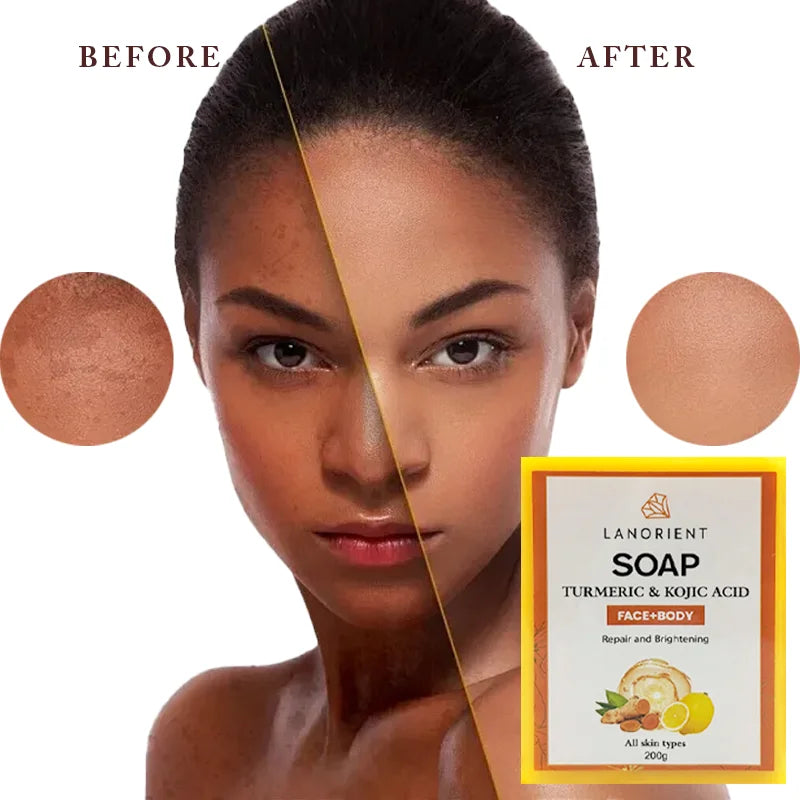 Kojic Acid Dark Spot Remove Soap for Cleaning the Face Whitening Oil Control Even Tone Skin Products Natural Turmeric Soap Bar