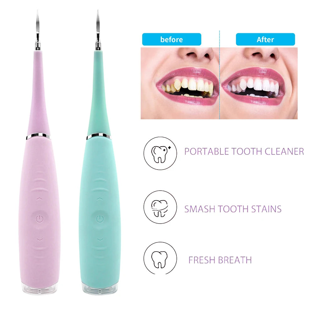 Convenient ABS Tooth Calculus Remover Easy Removal of Dental Smoke Tea Stains Five Adjustable Health Hygiene Features