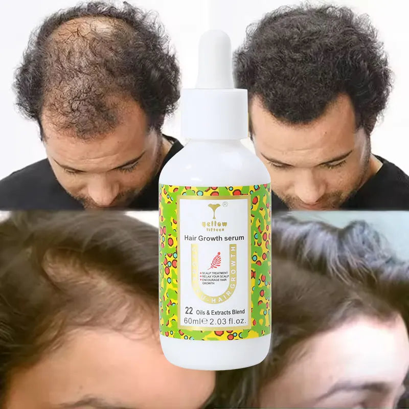 Private Label Biotin Hair Growth Scalp Serum Ginger Rosemary Oil Nourishing Scalp Anti Hair Loss Hair Growth Serum Oil 100 ml