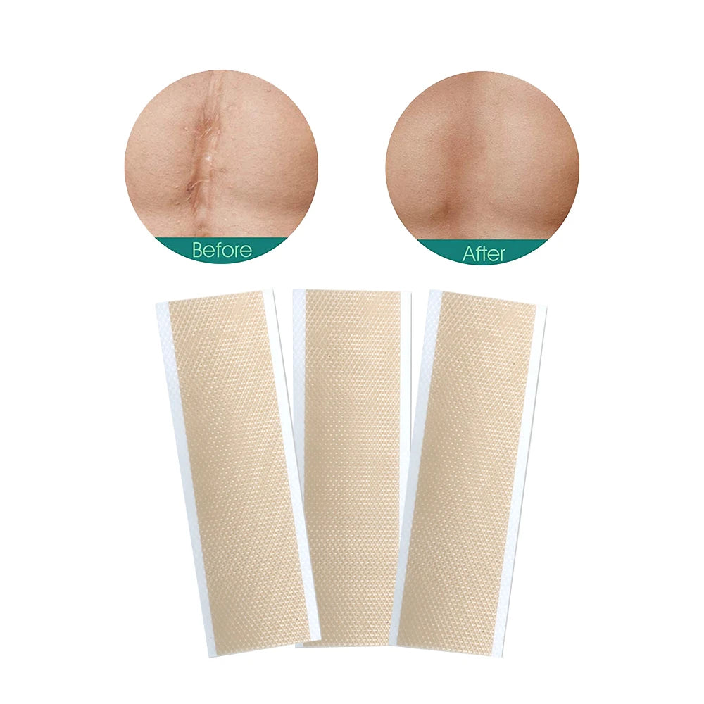 Trending Products Silicone Gel Sheet Scar Remover Body Scar Reduction Patches for Removing Scar
