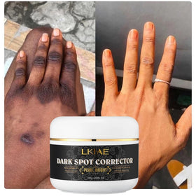 LKIAE Pearl Bright 7 Days Dark Spot Corrector Stronger Organic Vegan Whitening & Lightening Body Cream for All Skin Types