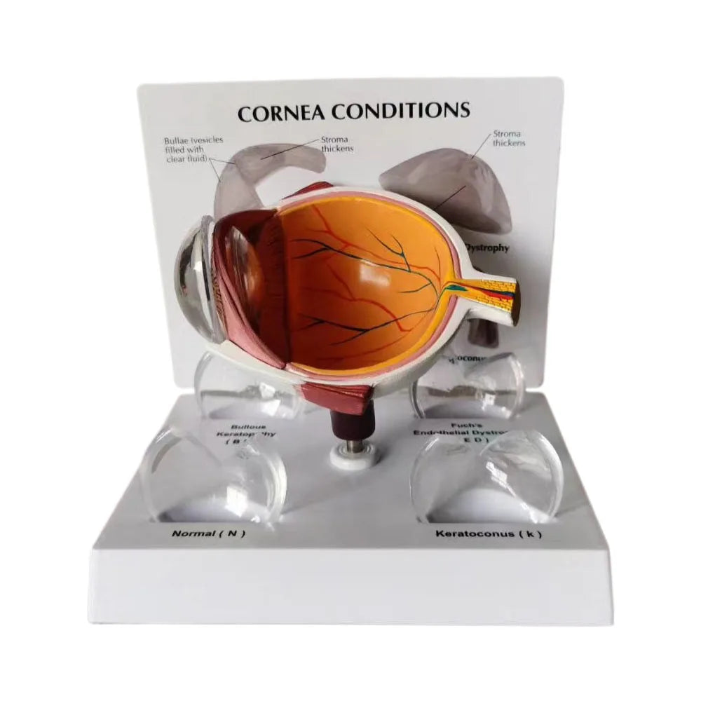 Human Eye Anatomy Model PVC Cornea Conditions for Medical Education for Schools and Hospitals