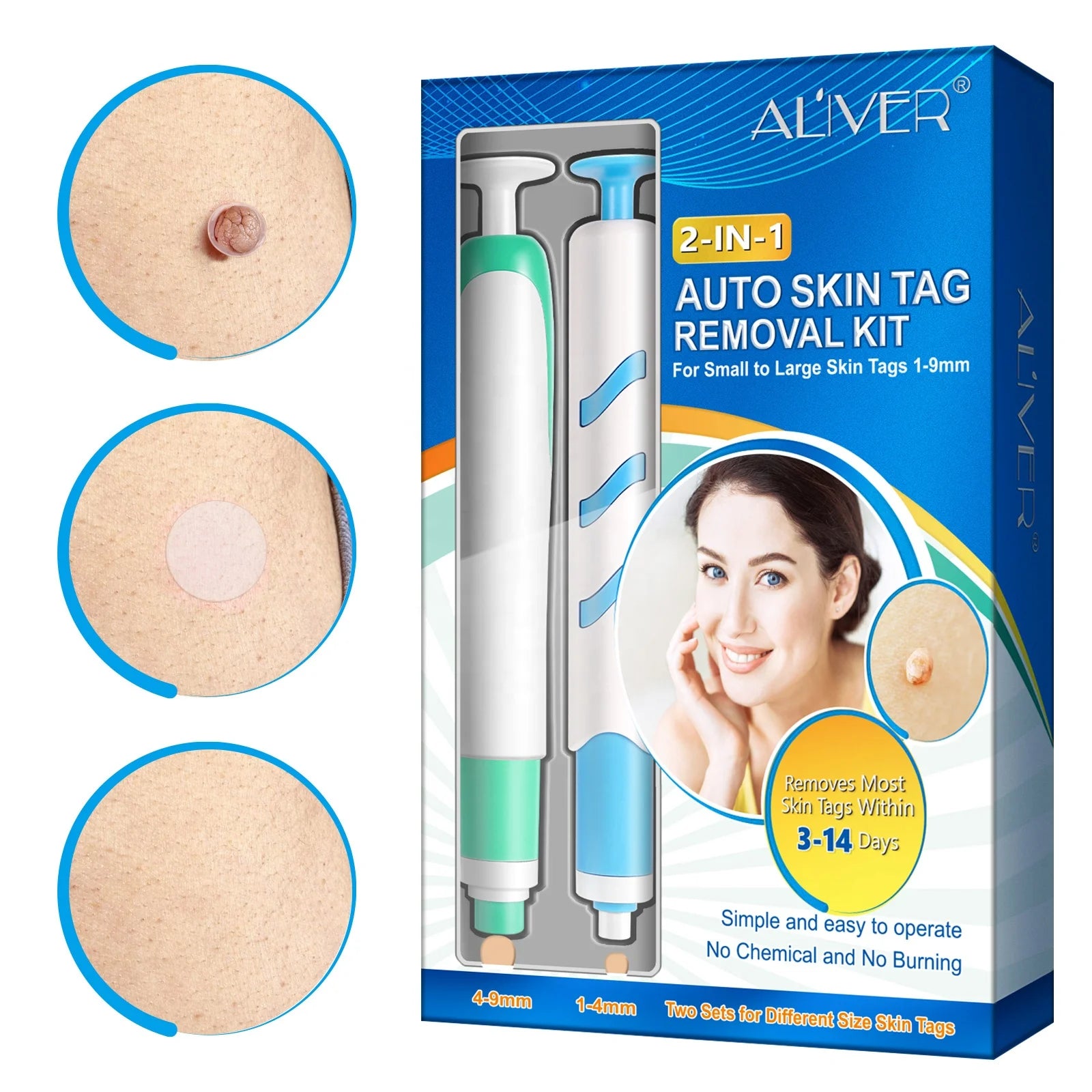 ALIVER OEM 2 in 1 Auto Small Large Tag Suitable Gentle Hassle Free Skin Repair Tools Wart Skin Tag Removal Kit