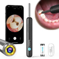 For R1 Intelligent Wireless 3MP Camera Ear Cleaning Tool 3-Axis Gyroscope 130mAh Battery for Dental Oral/Nasal Cavity