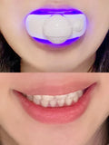 VERY STRONG FAST TEETH TOOTH WHITENING KIT Including Mouth Trays
