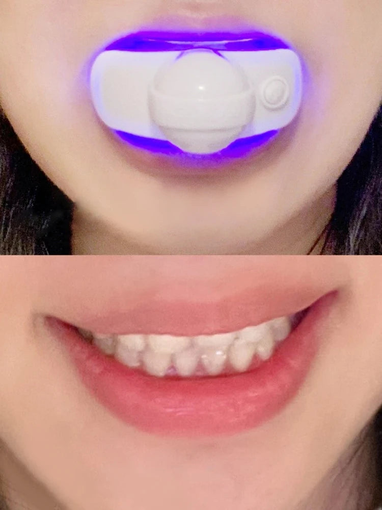 VERY STRONG FAST TEETH TOOTH WHITENING KIT Including Mouth Trays
