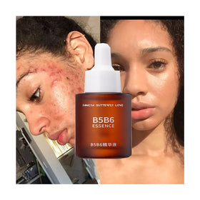 Customized Skin Care Products 30ML Vitamin B5 B6 Brightens Essential Oil Nourishing Anti Wrinkle Aging Tender Face Serum