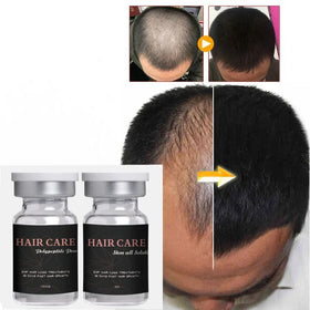 Anti-hair Loss Solution Hair Growth Kit Natural Anti Hair Loss Serum Beard Growth Set Scalp Care Alopecia Solution G