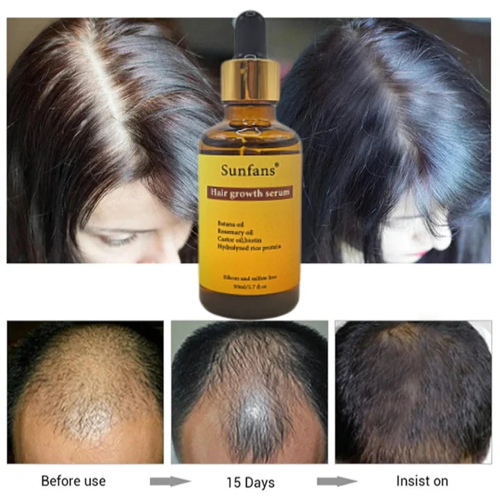 Organic Natural Eco Hair Growth Serum 50ML Herbal Vegan Nourishing Cruelty-Free Repair Damage Prevention with Rosemary Argan Oil