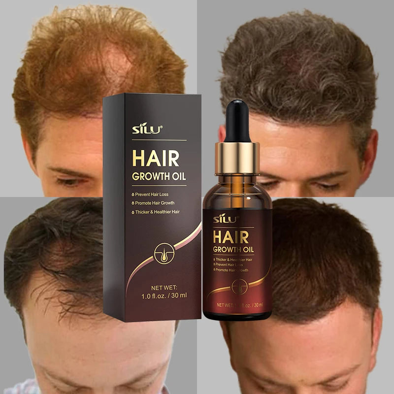 Professional Comfortable Hair Growth Treatment Extract Argan Oil Hair Growth Serum for Black Women