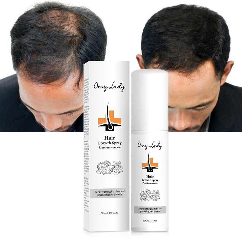 Free OEM Private Label Natural Ginger Herbal Formula for Scalp Repair Anti Hair Loss Hair Growth Shampoo