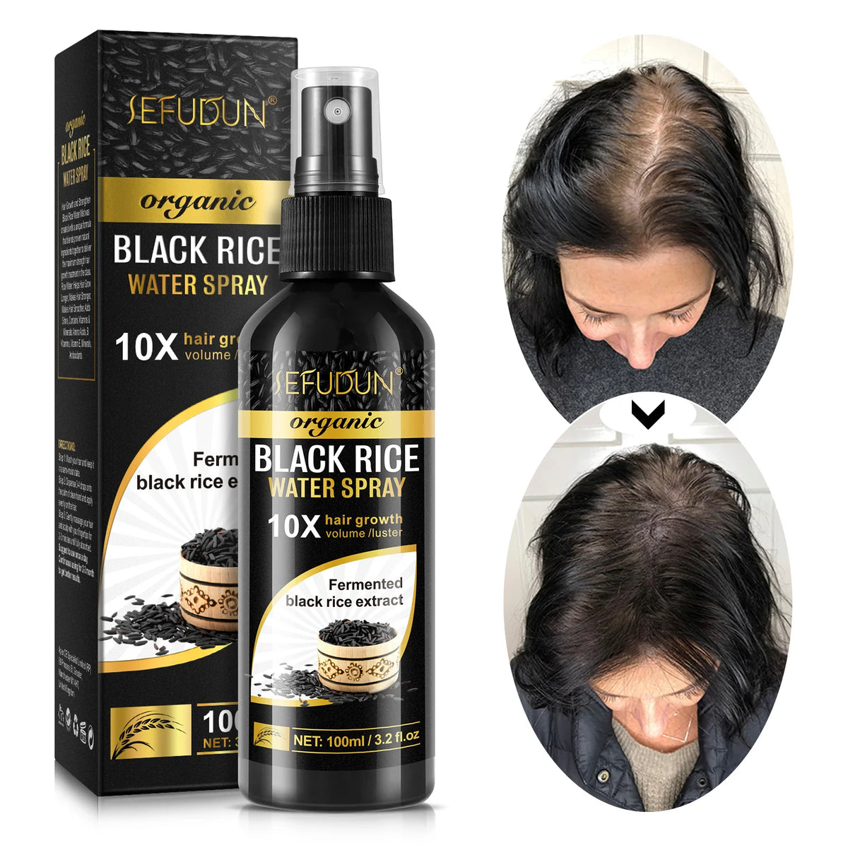 SEFUDUN 100Ml Organic Powerful Hair Loss Treatment Black Rice Water Hair Growth Spray for Men and Women