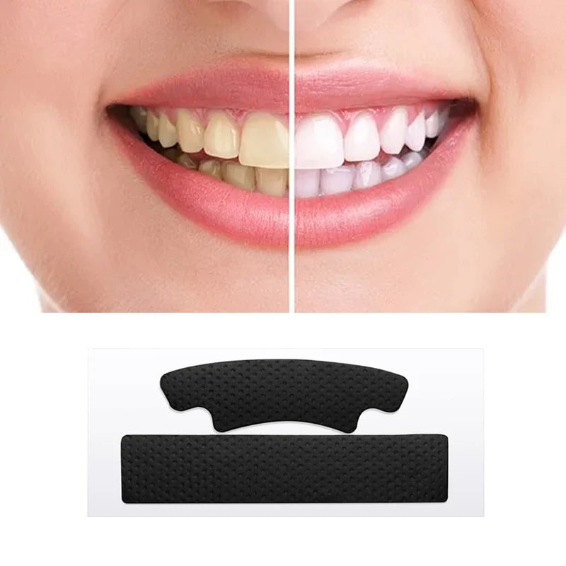Wholesale White Label Natural Charcoal Mint Tooth Whitening Strips with 30-60 Minute Treatment and Paper Box Packaging for Teeth