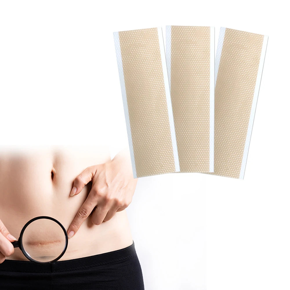 Wholesale Breathable Skin Friendly Scar Away Silicone Gel Scar Remover Pads Skin Care Tape