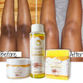 Wholesale OEM Dark Knees Knuckles Elbows Armpit Whitening Bleaching Serum Cream Body Lotion Oil Skin Care Set for Dark Skin