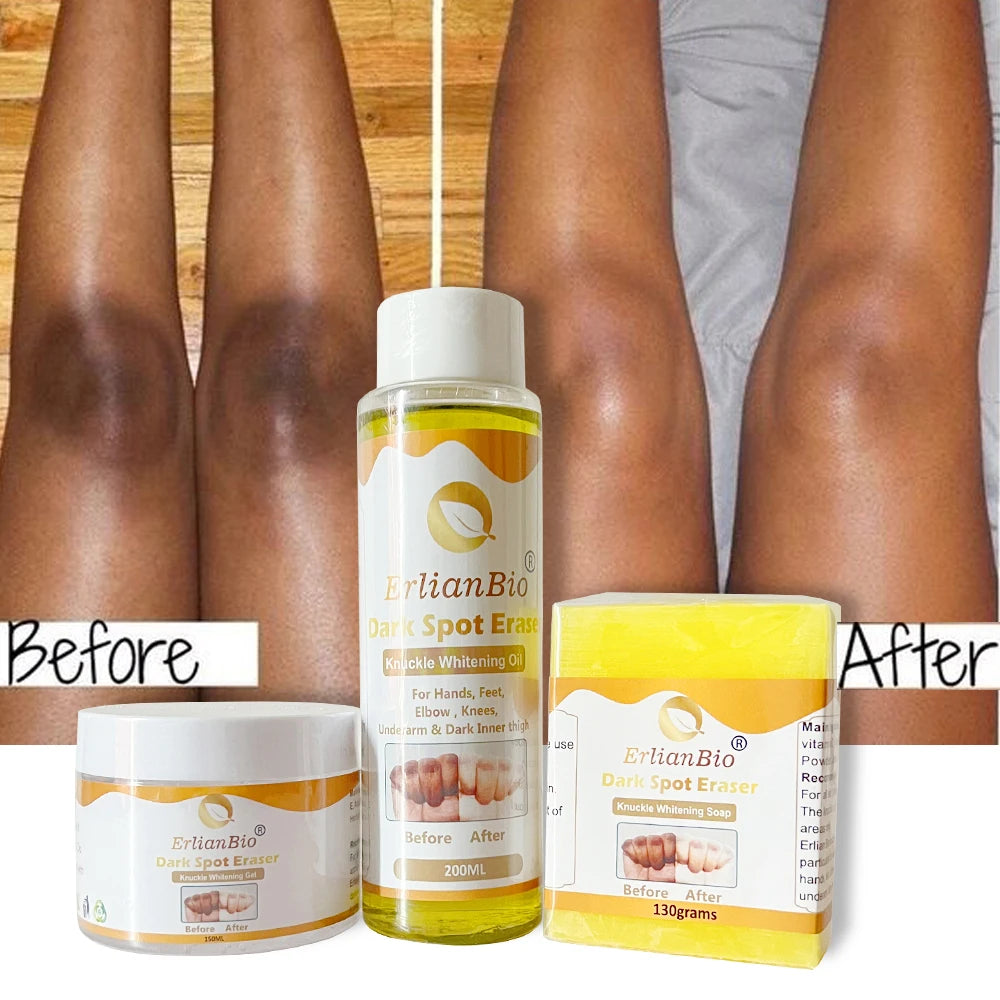 Wholesale OEM Dark Knees Knuckles Elbows Armpit Whitening Bleaching Serum Cream Body Lotion Oil Skin Care Set for Dark Skin