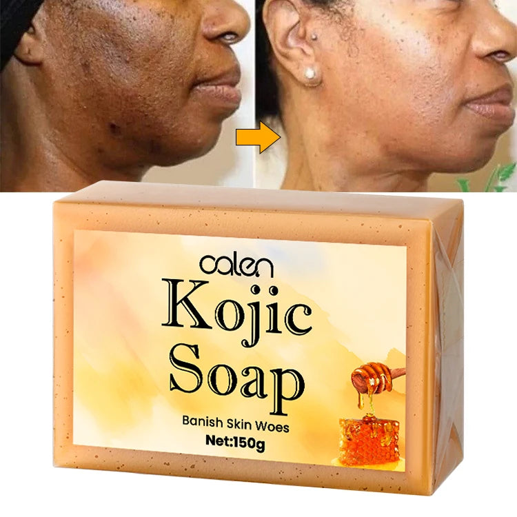 Oalen Private Label Skin Whitening Nature Honey Face Soap Handmade Kojic Acid Soap