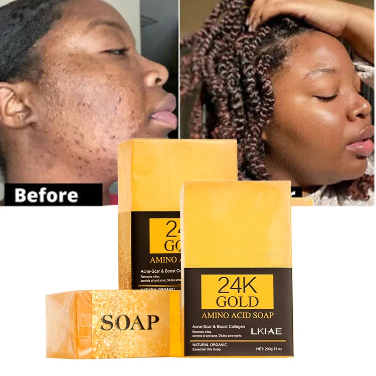 Private Label Facial 24K Gold Soap Olive Oil Toilet Acne Removal Collagen Anti Aging Hyperpigmentation Soap