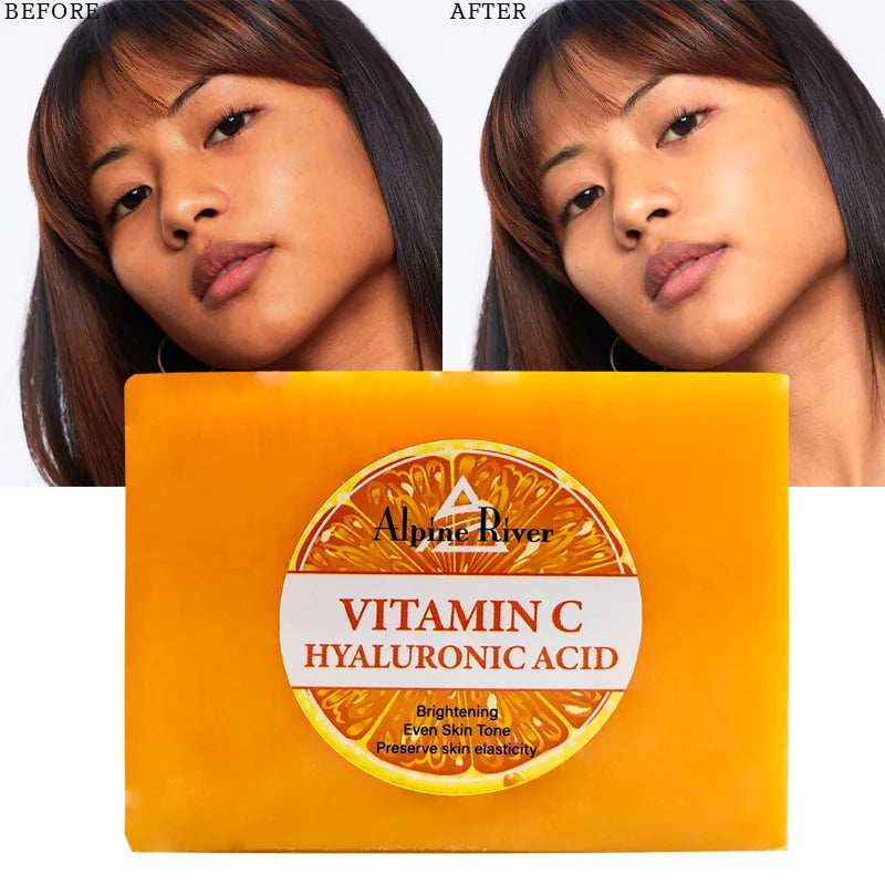 Private Label Natural Organic Skin Brightening Even Skin Tone Vitamin C Hyaluronic Acid Face Soap for Women