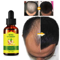 OEM Wholesale 30ml Ginger Oil Hair Restoration Growth Oil for Hair Loss Treatment Regrowth Serum Personal Care Products