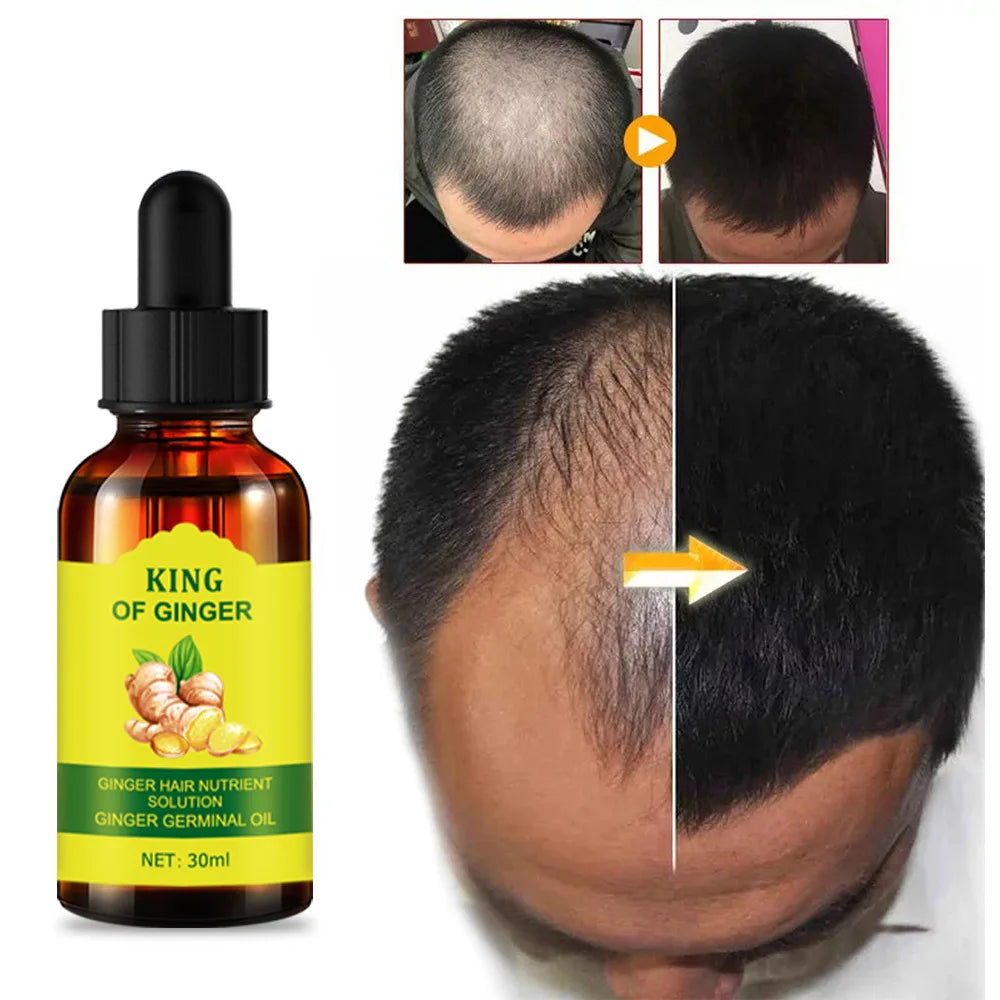 OEM Wholesale 30ml Ginger Oil Hair Restoration Growth Oil for Hair Loss Treatment Regrowth Serum Personal Care Products
