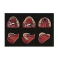 Partially Edentulous Dental Model for Medical Science Practice