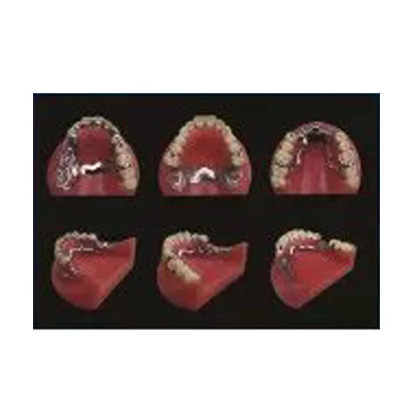 Partially Edentulous Dental Model for Medical Science Practice