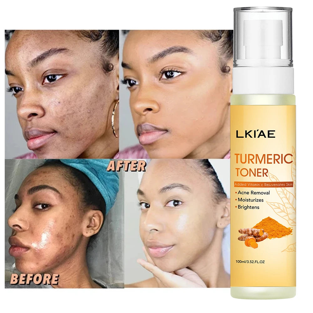 Ready to Ship Glow Vegan Turmeric Face Mist Spray Skin Care Products Whitening Face Toner Drop Shipping for Acne Marks