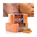 Natural Turmeric Soap Bar for Skin Brightening Dark Spots Reduces Acne Fades Scars Cleanses Skin Handmade Turmeric Soap