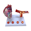 Human Anatomy Heart Model Coronary Artery Bypass and Vascular Thrombosis Educational Equipment