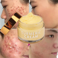 OEM Natural Dark Spot Remover Whitening Vitamin C Anti-Aging/Anti-Wrinkle Moisturizer Anti-Acne Turmeric Face Cream 50g