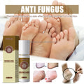 Foot Peeling Spray Natural Herb Essence Pedicure Prevent Odor Deodorizing Foot Spray