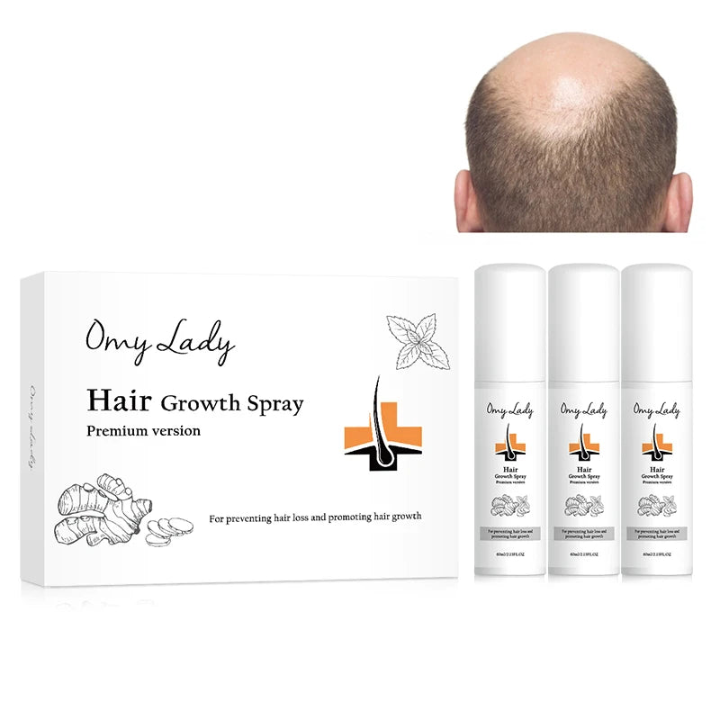 Sample Fast Door to Door Shipping Chinese Herbal Formula Hair Growth Spray Women