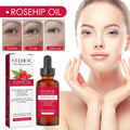 EELHOE Body Massaging Rosehip Essential Oil Dandruff Removing Hair Oil Anti Wrinkle Moisturizing Organic Rosehip Oil for Face