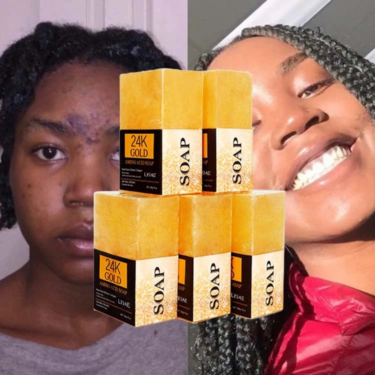 OEM ODM 100% Natural Organic Collagen 24K Gold Foil Amino Acid Anti-Aging Handmade Whitening Shea Butter Bath Soap 200g