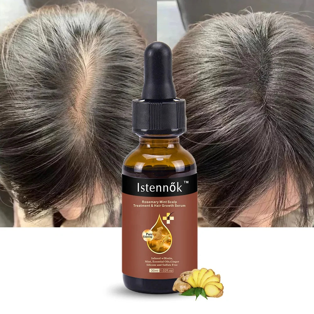 Hot Launch Natural Hair Oil Encourages Hair Growth Reduces Protein Loss Contains Hyaluronic Acid Coconut Oil Ginger Hair Tonics