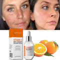 Hot Selling Organic Vitamin C Whitening Face Serum Remove Dark Circles Fade Spots Anti Aging Skin Care Serum