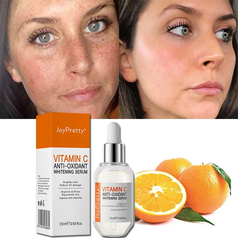 Hot Selling Organic Vitamin C Whitening Face Serum Remove Dark Circles Fade Spots Anti Aging Skin Care Serum