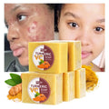 Ailke Wholesale 100% Natural Ginger Turmeric Bath Soap Brightening Body Handmade Acne Remover Tumeric Turmeric Soap