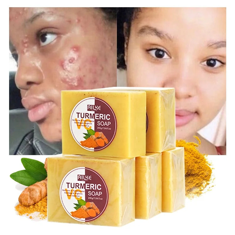 Ailke Wholesale 100% Natural Ginger Turmeric Bath Soap Brightening Body Handmade Acne Remover Tumeric Turmeric Soap