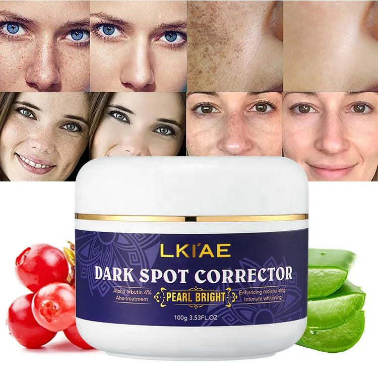 (New) Private Label Skin Freckles Dark Spot Skin Pigmentation Lightening Skin Care Whitening Face Cream & Lotion