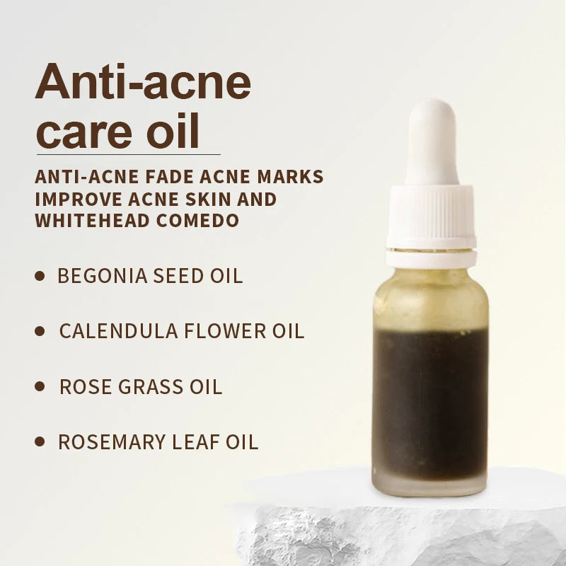 Anti-acne Face Care Skin Treatment Cleaning Oil Private Label Improve Acne Prone Skin Oil-control Soothing Serum Oil